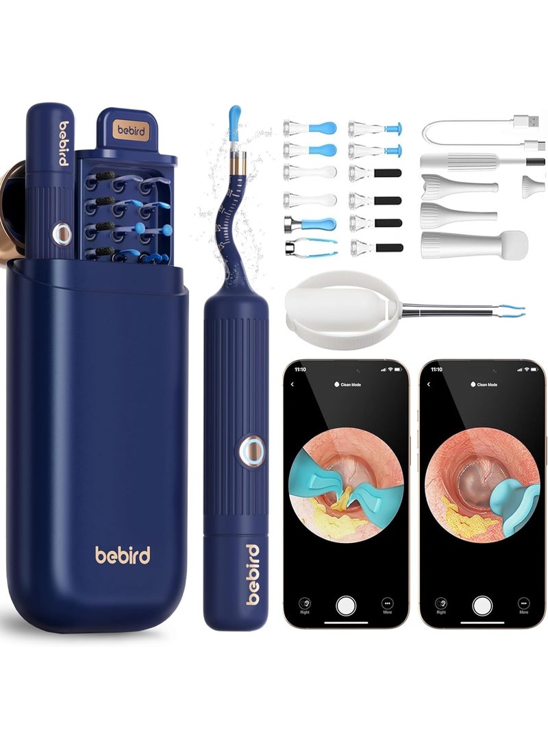 بيبيرد أداة إزالة شمع الأذن Earsight Plus I35R المزودة بكاميرا | منظف أذن ذكي مزود بملقط لطيف و12 طرفًا، منظار أذن عالي الدقة للبالغين والأطفال - Image 1